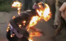 Niakhar : Largué par sa copine étudiante, il s’immole par le feu