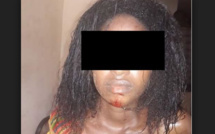 L’histoire de Awa Diop, qui a failli être égorgée par son mari