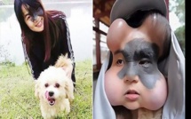 Chine: 4 ballons implantés dans le visage d’une femme pour sauver sa vie