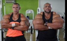 Brésil: ils s’injectent des produits chimiques pour gonfler leurs biceps (Photos)