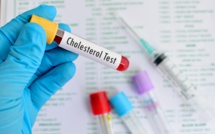 Le Cholestérol - Ce que vous pouvez faire pour abaisser votre taux.