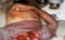 Photo inédite de Moussa Dadis Camara couché par terre après son agression