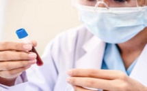 Science: Un nouveau test sanguin pourrait révéler combien de temps il vous reste à vivre