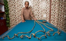 L'homme aux ongles les plus longs du monde a fini par les couper (vidéo)
