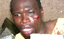 ITALIE: Un jeune sénégalais sauvagement agressé par des italiens