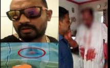 Horreur en Inde : Un homme crève l’œil de son père. La raison (vidéo)