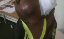  Cri du cœur d'une mère éplorée : "Mon enfant a un cancer et souffre terriblement !" (Diatou Fall)