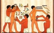 La circoncision fait baisser le risque d’attraper le VIH