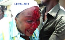 [Exclusif] La chanteuse Aicha Koné tabassée par les Jeunes patriotes