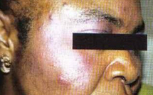 CAMEROUN : LES CAMEROUNAISES SE DÉCAPENT DE PLUS EN PLUS LA PEAU