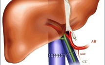 Un homme avoue avoir tué son ami et avoir mangé des morceaux de son foie