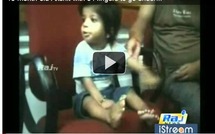 Un petit indien est né avec 34 doigts (vidéo)