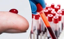 INCROYABLE ! Un nouveau test sanguin créé pour prédire la mort