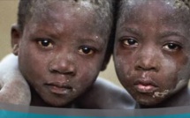 VIDEO - Du nouveau dans l'affaire des enfants égorgés à Touba