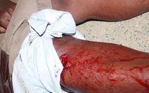 Aux manifestations du Week-end : Les secouristes n’ont pas chômé