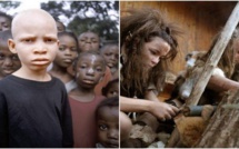 Etude : Découvrez comment les Européens ont eu la peau blanche