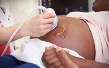 Quels sont les symptômes de la fausse couche ?