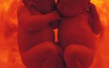 Indignation en Suisse après l'accouchement d'une retraitée de 66 ans