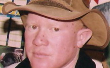 Mouhamadou Bamba Diop, albinos : "Nous sommes traqués avec des 4x4"