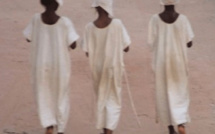 Circoncision ratée: Une infirmière sectionne le sexe d’un garçon et se fait arrêter