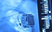 Un appareil implanté près du cœur pour prévenir l'infarctus