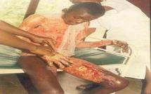 La jalousie: crise naturelle ou pathologie?