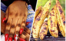 Dépigmentation : Ce cocktail mortel qui fait des ravages