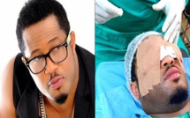 L’acteur nigérian Mike Ezuruonye a subi une chirurgie des yeux (photo)