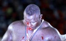 Le prix du sang qui fait perdre Bombardier