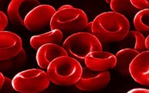 L’anémie : une maladie qu’il faut prévenir et traiter