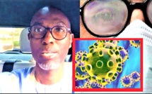 Covid-19 / Port de lunettes: Pr. Moussa Seydi apporte des éclaircissements (VIDEO)