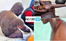 VIDEO - Kawtef à Touba: Une femme  ébouillante son mari - LERAL TV