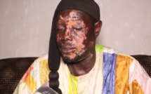 VIDEO - Agressé devant sa femme, le chef de la sécurité du Grand Théâtre national, a frôlé la mort 