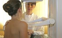 Le dépistage du cancer du sein