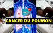 DEMANDE D'AIDE - CETTE JEUNE FILLE DE 19ANS SOUFFRE DE LA MALADIE DU CANCER DU POUMON