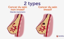 VIDEO - "Il y'a différents types de cancer du sein, chaque femme doit s'autopalper pour...."