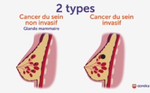 VIDEO - "Il y'a différents types de cancer du sein, chaque femme doit s'autopalper pour...."