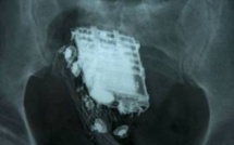 Un détenu trahi par la sonnerie du portable dissimulé dans... son corps