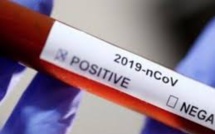 Covid-19: Le prix des tests rapides divisé par deux pour les pays en développement