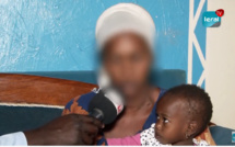 Bébé Coumba, 1 an, souffre d'une maladie cardiaque: 1 300 000 FCfa à trouver pour les besoins de son opération