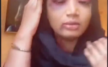 Après avoir agressé sa voisine: Sirakha Sima fait le fou pour éviter la prison