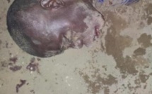 Coups de pied dans l’estomac, et des coups dans le visage, un marchand sénégalais agressé en Italie