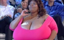 Image d'une femme aux seins qui pèsent chacun… 26 kg!