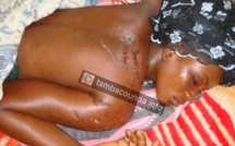 [Photos]Tambacounda : Un Mari sectionne à coup de machette sa femme âgée de 18 ans 