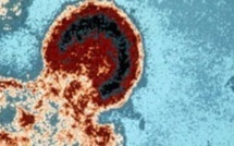 La circoncision réduit les risques du Sida