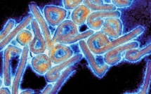 Maladie à virus de Marburg: Un premier cas confirmé en Guinée