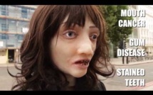 [Vidéo] À Londres, les fumeurs interpellés en rue par des faux cancéreux