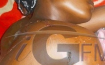 (Photos + Vidéos) Battue à coup de machette par son mari, Awa Dagnokho est sortie de l’hôpital