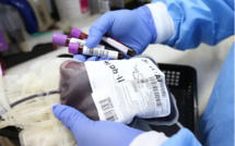 Hépatite B: 10% de la population sénégalaise infectés