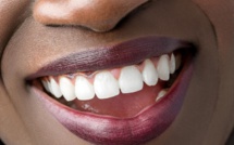 Refaire sa dentition, ou une partie de son corps : Chez certaines célébrités, une pratique devenue monnaie courante